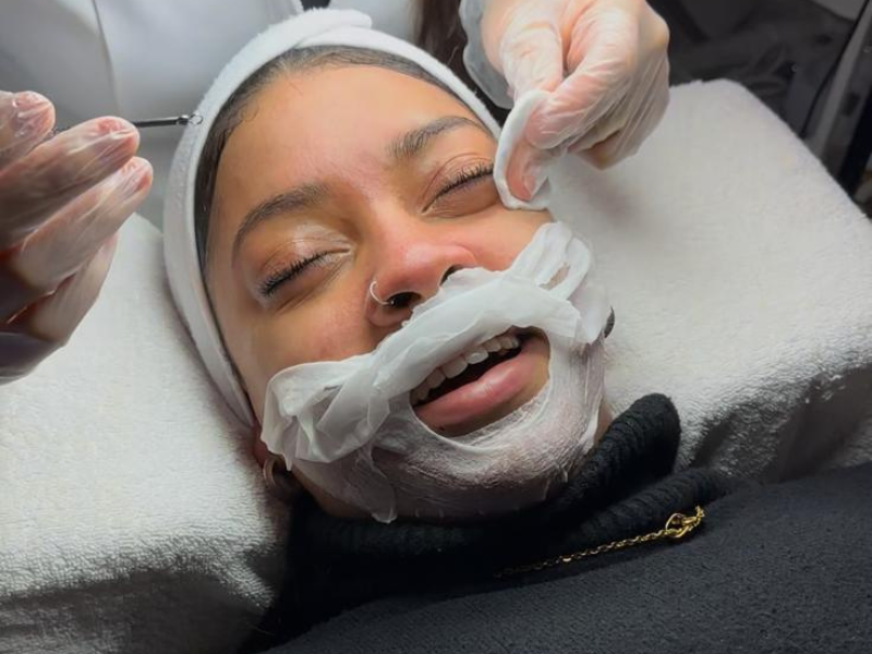 limpeza-de-pele-radiofrequencia-amat-estetica-porto