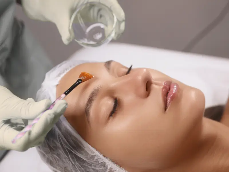 Cuidados Pós Peelings