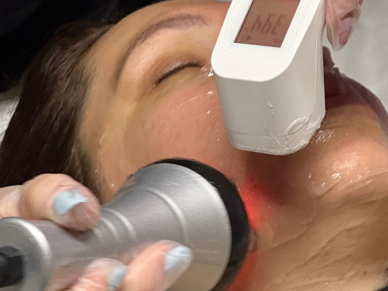 Radiofrequência Facial no Porto: Como Funciona a Limpeza de Pele com Radiofrequência?