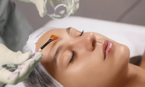 Cuidados Pós Peelings