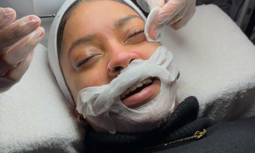 limpeza-de-pele-radiofrequencia-amat-estetica-porto